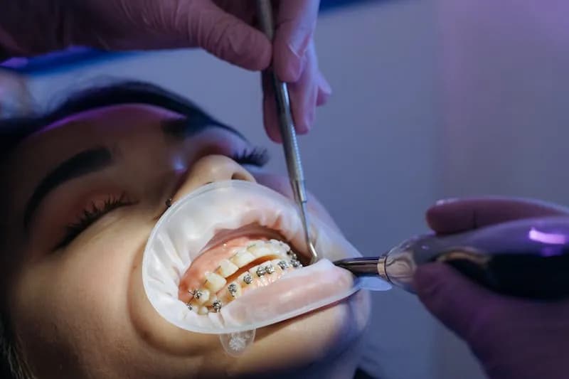 Braces & Aligners